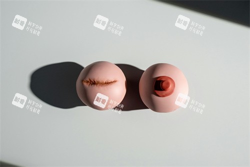 乳晕手术整形展示图.jpg