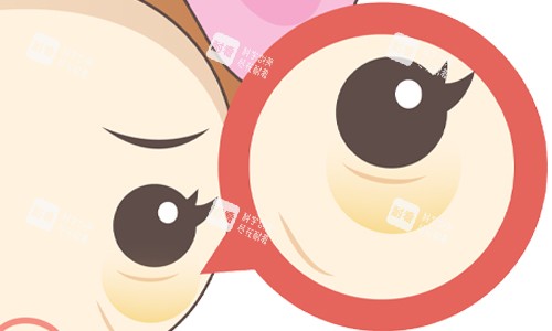 眼袋展示图.jpg 眼袋展示图.jpg