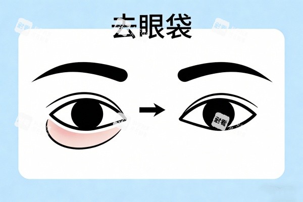 祛除眼袋前后对比图.jpg 祛除眼袋前后对比图.jpg
