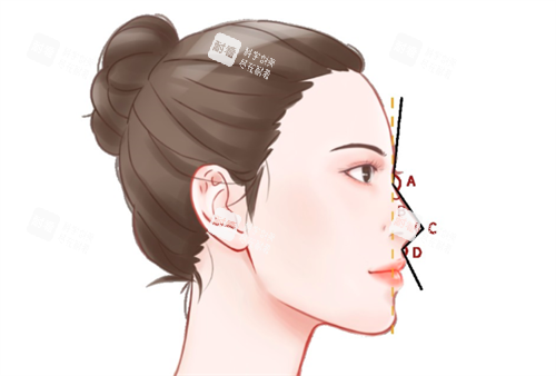 鼻部整形展示.png 鼻部整形展示.png