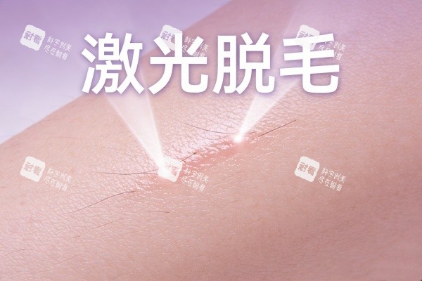 激光脱毛卡通展示图.jpg 激光脱毛卡通展示图.jpg