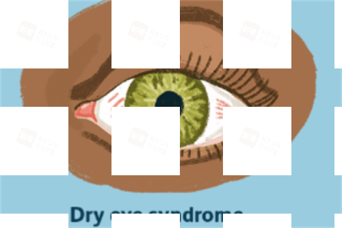 干眼综合征.png