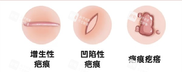 疤痕修复.jpg