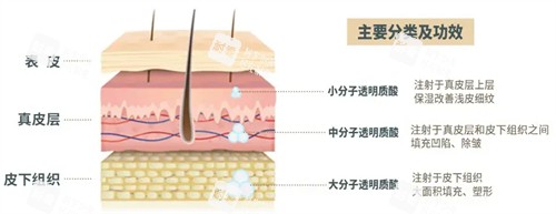 玻尿酸注射后皮肤变化.jpg