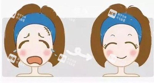 激光美容前后对比卡通示意图.jpg 激光美容前后对比卡通示意图.jpg