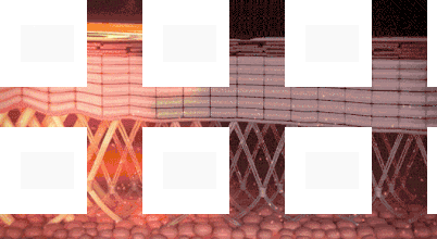 热玛吉.gif