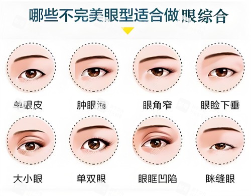 哪些眼型适合做眼综合示例动画图.jpg 哪些眼型适合做眼综合示例动画图.jpg