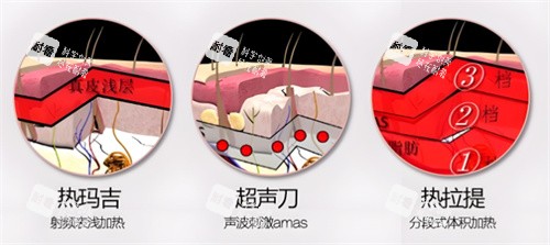 面部提升项目对比.jpg 面部提升项目对比.jpg